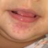 É normal bebe de 3 meses ficar dias sem fazer coco ?